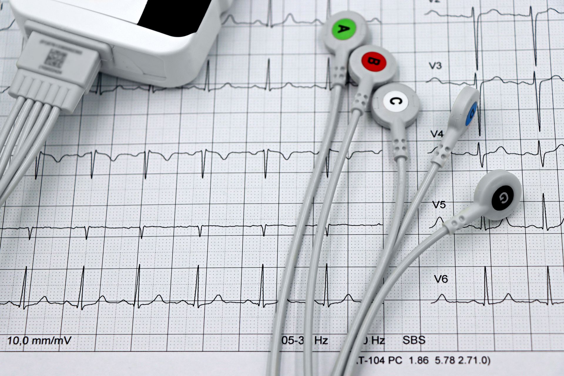 ECG equipment illustrating recording of the heart's electrical activity