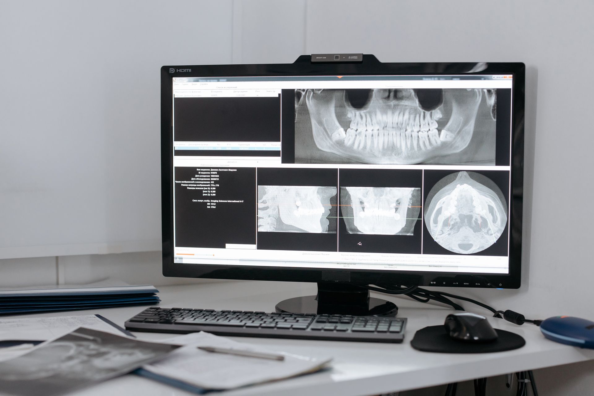 X-ray imaging equipment representing the hospital's listed X-ray facility